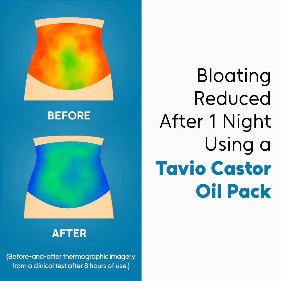 Celara™ Castor Oil Pack Bundle