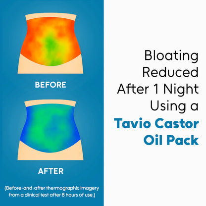 Celara™ Castor Oil Pack Bundle